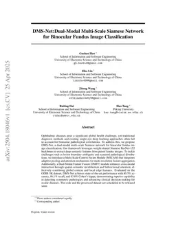 DMS-Net:Dual-Modal Multi-Scale Siamese Network for Binocular Fundus Image Classification