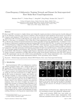 Cross-Frequency Collaborative Training Network and Dataset for Semi-supervised First Molar Root Canal Segmentation