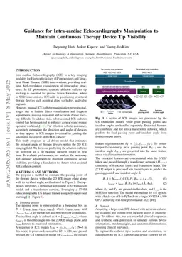 Guidance for Intra-cardiac Echocardiography Manipulation to Maintain Continuous Therapy Device Tip Visibility