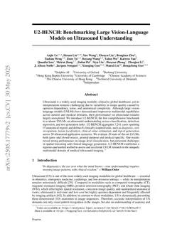 U2-BENCH: Benchmarking Large Vision-Language Models on Ultrasound Understanding