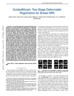 GuidedMorph: Two-Stage Deformable Registration for Breast MRI