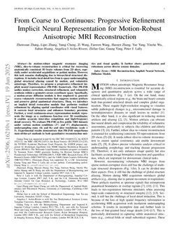 From Coarse to Continuous: Progressive Refinement Implicit Neural Representation for Motion-Robust Anisotropic MRI Reconstruction