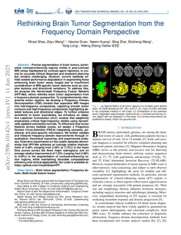 Rethinking Brain Tumor Segmentation from the Frequency Domain Perspective