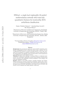 EXGnet: a single-lead explainable-AI guided multiresolution network with train-only quantitative features for trustworthy ECG arrhythmia classification