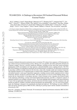 TUS-REC2024: A Challenge to Reconstruct 3D Freehand Ultrasound Without External Tracker