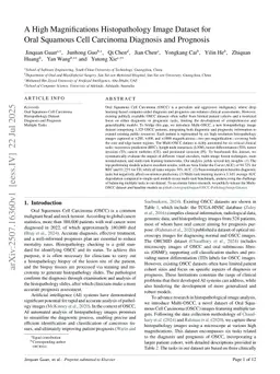 A High Magnifications Histopathology Image Dataset for Oral Squamous Cell Carcinoma Diagnosis and Prognosis