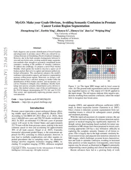 MyGO: Make your Goals Obvious, Avoiding Semantic Confusion in Prostate Cancer Lesion Region Segmentation