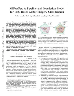 MIRepNet: A Pipeline and Foundation Model for EEG-Based Motor Imagery Classification