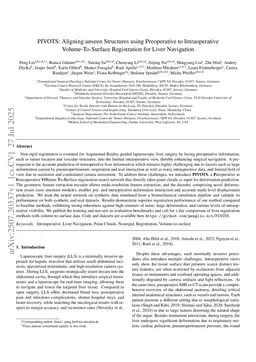 PIVOTS: Aligning unseen Structures using Preoperative to Intraoperative Volume-To-Surface Registration for Liver Navigation