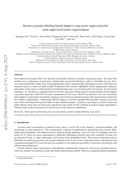 Iterative pseudo-labeling based adaptive copy-paste supervision for semi-supervised tumor segmentation