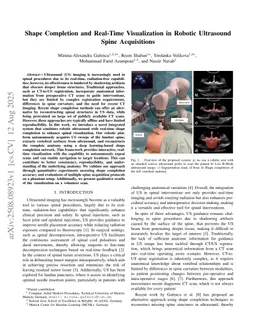 Shape Completion and Real-Time Visualization in Robotic Ultrasound Spine Acquisitions
