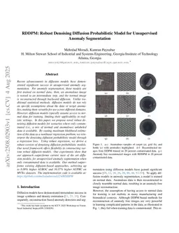 RDDPM: Robust Denoising Diffusion Probabilistic Model for Unsupervised Anomaly Segmentation
