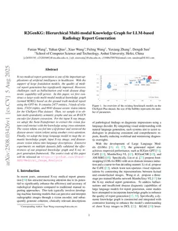 R2GenKG: Hierarchical Multi-modal Knowledge Graph for LLM-based Radiology Report Generation