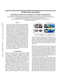 JanusNet: Hierarchical Slice-Block Shuffle and Displacement for Semi-Supervised 3D Multi-Organ Segmentation