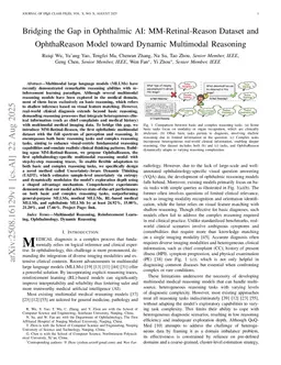 Bridging the Gap in Ophthalmic AI: MM-Retinal-Reason Dataset and OphthaReason Model toward Dynamic Multimodal Reasoning