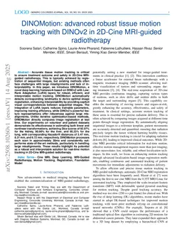 DINOMotion: advanced robust tissue motion tracking with DINOv2 in 2D-Cine MRI-guided radiotherapy