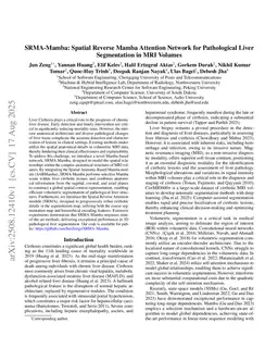 SRMA-Mamba: Spatial Reverse Mamba Attention Network for Pathological Liver Segmentation in MRI Volumes