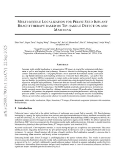 Multi-needle Localization for Pelvic Seed Implant Brachytherapy based on Tip-handle Detection and Matching