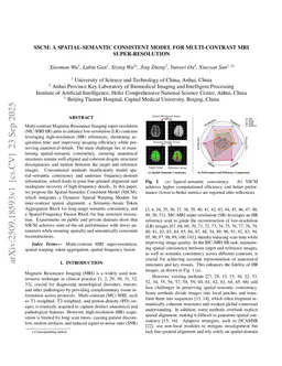 SSCM: A Spatial-Semantic Consistent Model for Multi-Contrast MRI Super-Resolution
