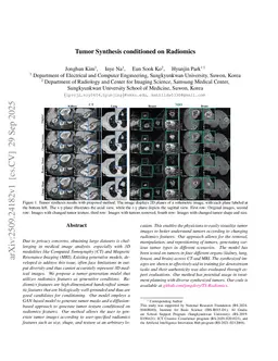 Tumor Synthesis conditioned on Radiomics
