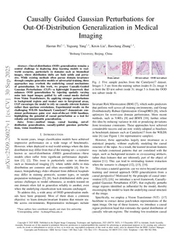 Causally Guided Gaussian Perturbations for Out-Of-Distribution Generalization in Medical Imaging