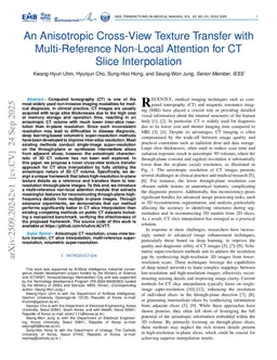 An Anisotropic Cross-View Texture Transfer with Multi-Reference Non-Local Attention for CT Slice Interpolation