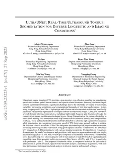 UltraUNet: Real-Time Ultrasound Tongue Segmentation for Diverse Linguistic and Imaging Conditions
