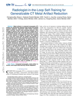 Radiologist-in-the-Loop Self-Training for Generalizable CT Metal Artifact Reduction