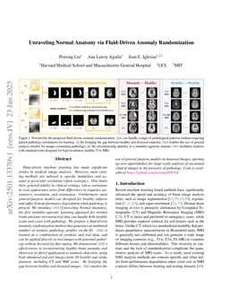 Unraveling Normal Anatomy via Fluid-Driven Anomaly Randomization