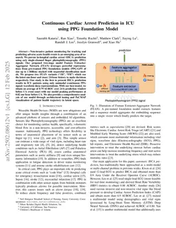Continuous Cardiac Arrest Prediction in ICU using PPG Foundation Model