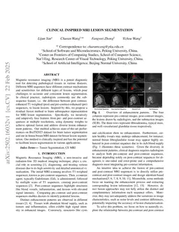 Clinical Inspired MRI Lesion Segmentation