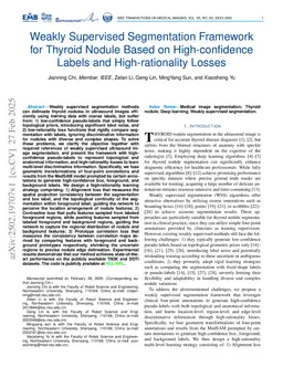 Weakly Supervised Segmentation Framework for Thyroid Nodule Based on High-confidence Labels and High-rationality Losses