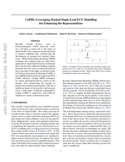 CuPID: Leveraging Masked Single-Lead ECG Modelling for Enhancing the Representations