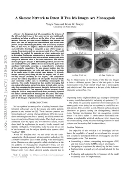 A Siamese Network to Detect If Two Iris Images Are Monozygotic