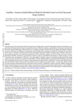 FetalFlex: Anatomy-Guided Diffusion Model for Flexible Control on Fetal Ultrasound Image Synthesis