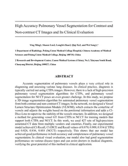 High Accuracy Pulmonary Vessel Segmentation for Contrast and Non-contrast CT Images and Clinical Evaluation