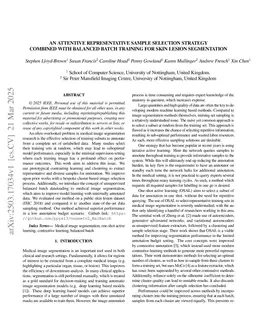An Attentive Representative Sample Selection Strategy Combined with Balanced Batch Training for Skin Lesion Segmentation
