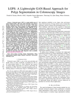 LGPS: A Lightweight GAN-Based Approach for Polyp Segmentation in Colonoscopy Images