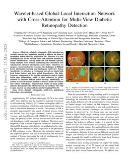 Wavelet-based Global-Local Interaction Network with Cross-Attention for Multi-View Diabetic Retinopathy Detection