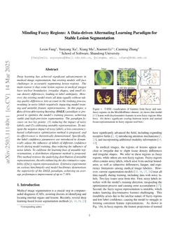 Minding Fuzzy Regions: A Data-driven Alternating Learning Paradigm for Stable Lesion Segmentation