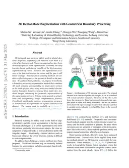 3D Dental Model Segmentation with Geometrical Boundary Preserving