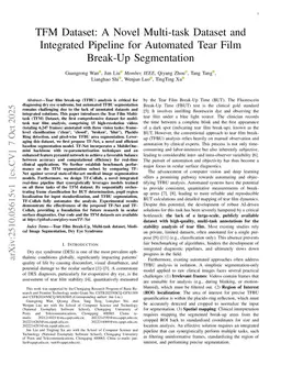 TFM Dataset: A Novel Multi-task Dataset and Integrated Pipeline for Automated Tear Film Break-Up Segmentation