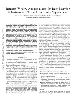 Random Window Augmentations for Deep Learning Robustness in CT and Liver Tumor Segmentation