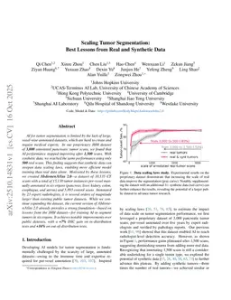 Scaling Tumor Segmentation: Best Lessons from Real and Synthetic Data