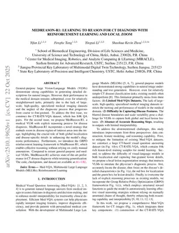 MedReason-R1: Learning to Reason for CT Diagnosis with Reinforcement Learning and Local Zoom