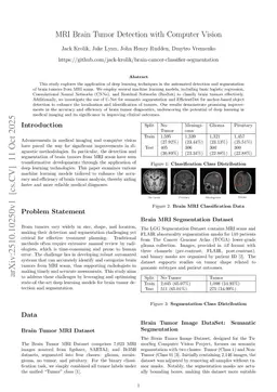 MRI Brain Tumor Detection with Computer Vision