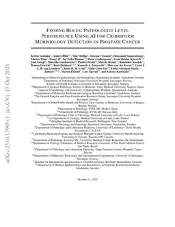 Finding Holes: Pathologist Level Performance Using AI for Cribriform Morphology Detection in Prostate Cancer