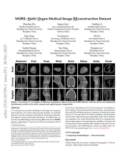 MORE: Multi-Organ Medical Image REconstruction Dataset