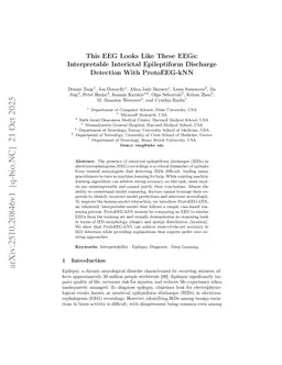 This EEG Looks Like These EEGs: Interpretable Interictal Epileptiform Discharge Detection With ProtoEEG-kNN