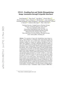 SWAN - Enabling Fast and Mobile Histopathology Image Annotation through Swipeable Interfaces